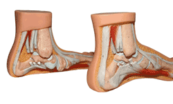 footcomparison2