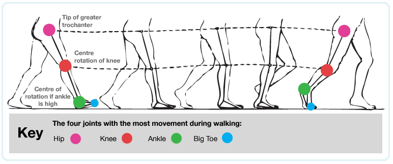 gait analysis